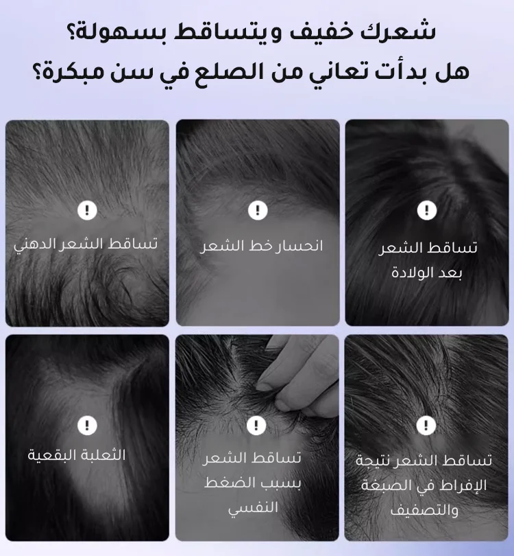 تغذية عميقة للشعر