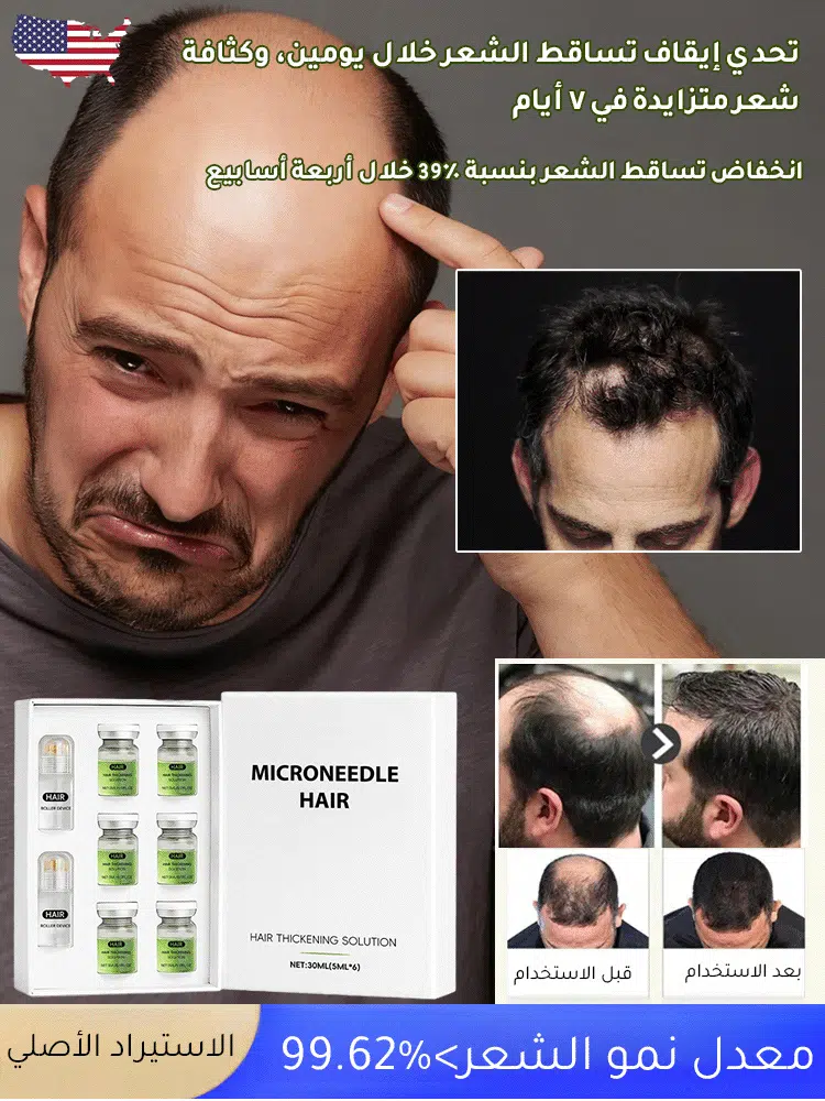 [انخفاض تساقط الشعر بنسبة 39٪ خلال أربعة أسابيع] سيروم إنبات الشعر برأس كروي 🔥